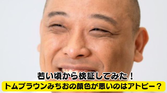 トムブラウン・みちおの顔色が悪いのはアトピー？若い頃から検証してみた！