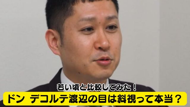 ドン デコルテ渡辺の目は斜視って本当？若い頃と比較してみた！